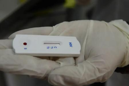 Novos casos de HIV caem no mundo, mas aumentam no Brasil, aponta relatório da ONU
