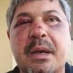 Suspeito de agredir brasileiro por xenofobia é preso em Portugal