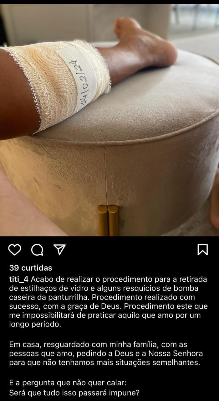 Zagueiro do Fortaleza passa por cirurgia após atentado e não tem data para voltar