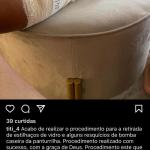 Zagueiro do Fortaleza passa por cirurgia após atentado e não tem data para voltar