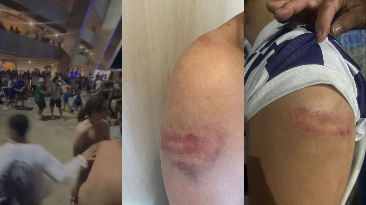 Vídeo: torcedor do Cruzeiro denuncia agressão da PM após jogo contra Flamengo no Mineirão