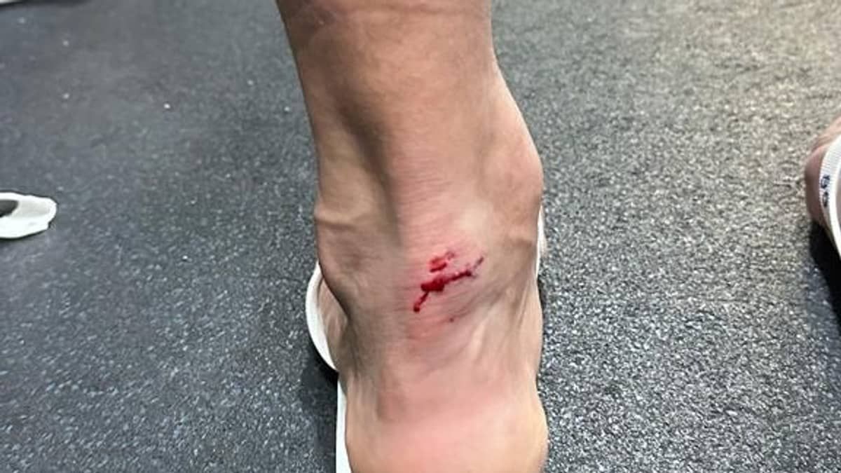 Fluminense reclama de falta em Cano; veja imagem do tornozelo do jogador