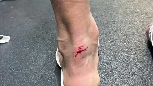 Tornozelo de Cano após a partida contra o Vasco, em pisão de Paulinho