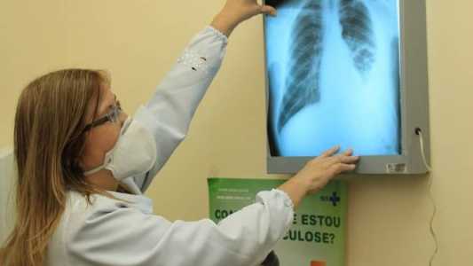 Tosse pode ser sintoma de várias doenças