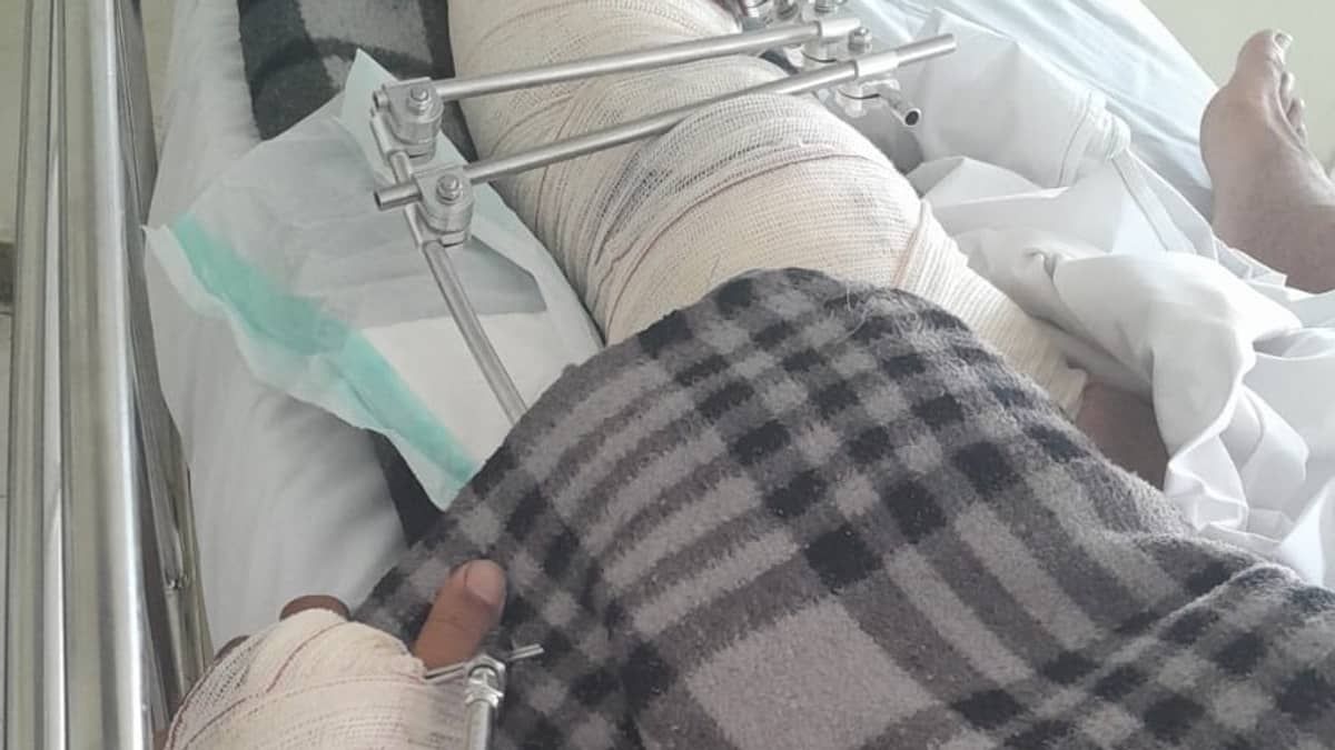 Vítimas de grave acidente com 99 Moto em BH relatam falta de assistência da plataforma