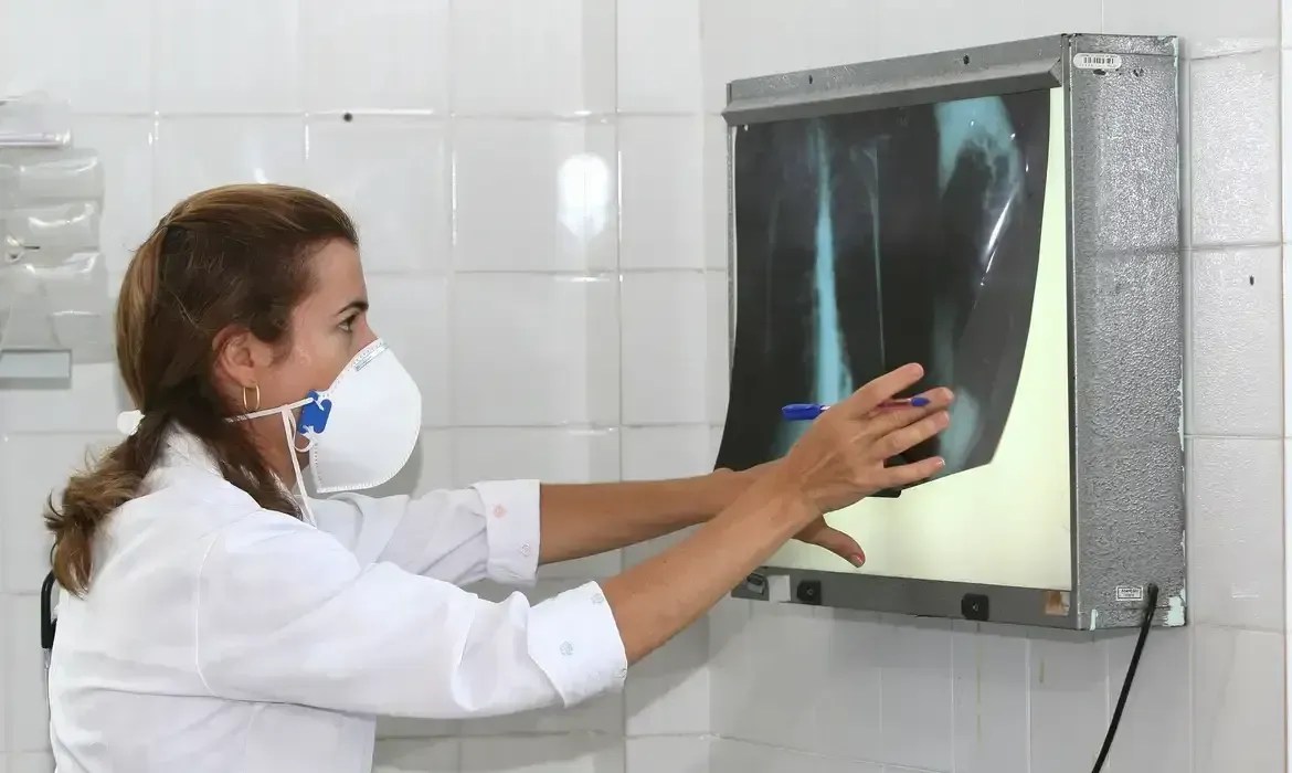 Dia Mundial da Tuberculose: mortes disparam em uma década no Brasil; conheça a doença