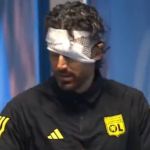 Técnico do Lyon, Fabio Grosso leva pedrada no rosto antes de clássico