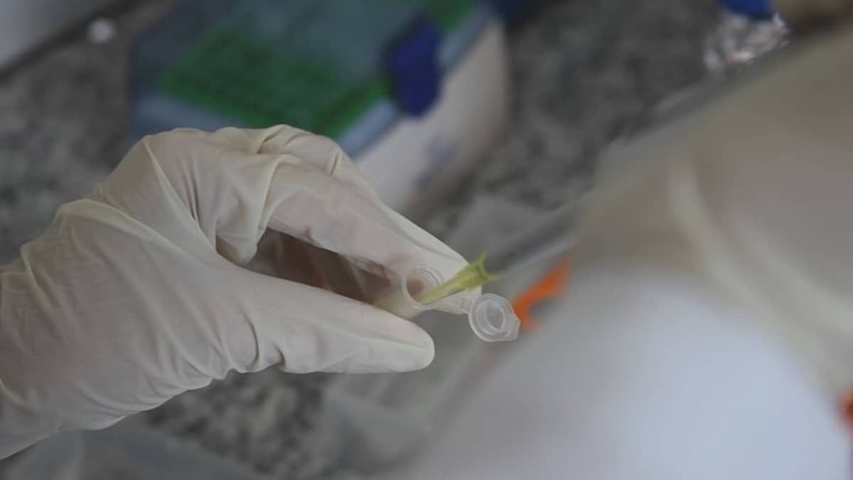 Calixcoca: saiba como funciona vacina premiada da UFMG contra vício em crack e cocaína  