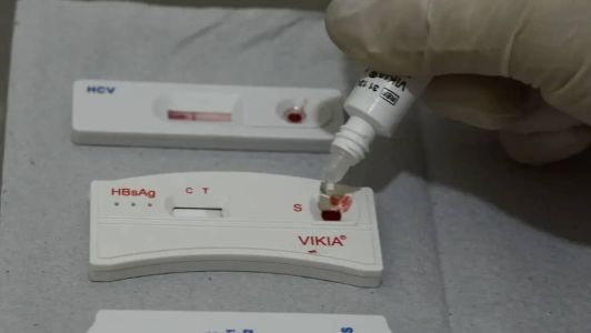 Quase 11 mil brasileiros morreram de Aids em 2022