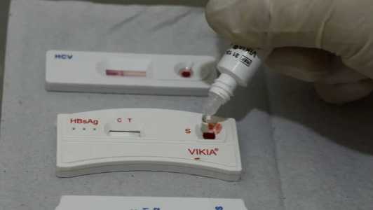 Quase 11 mil brasileiros morreram de Aids em 2022