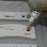 Dia Mundial de Luta contra a Aids: por que a doença ainda mata milhares de brasileiros por ano?