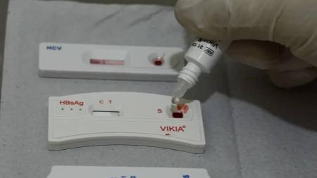 Quase 11 mil brasileiros morreram de Aids em 2022