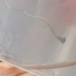 Vídeo: verme encontrado em Pedro Leopoldo assusta moradores 