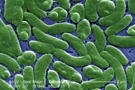 bacteria comedora de carne carnivora vibrio vulnificus