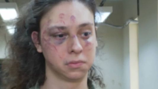 Victor Meyniel foi espancado em portaria de prédio e agressor foi autuado por homofobia