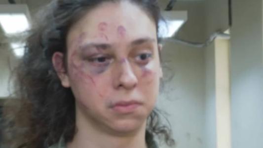 Victor Meyniel foi espancado em portaria de prédio e agressor foi autuado por homofobia