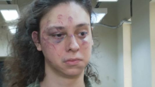 Victor Meyniel foi espancado em portaria de prédio e agressor foi autuado por homofobia