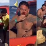 Turista agredido em Porto de Galinhas tem quatro fraturas no rosto e passa por cirurgia