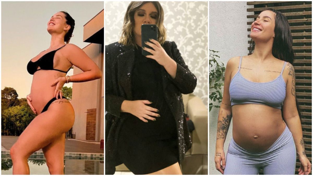 Além de Iza, Virginia, Marília Mendonça e outras famosas tiveram acne gestacional