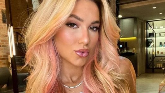 Virginia revelou quadro de alopecia