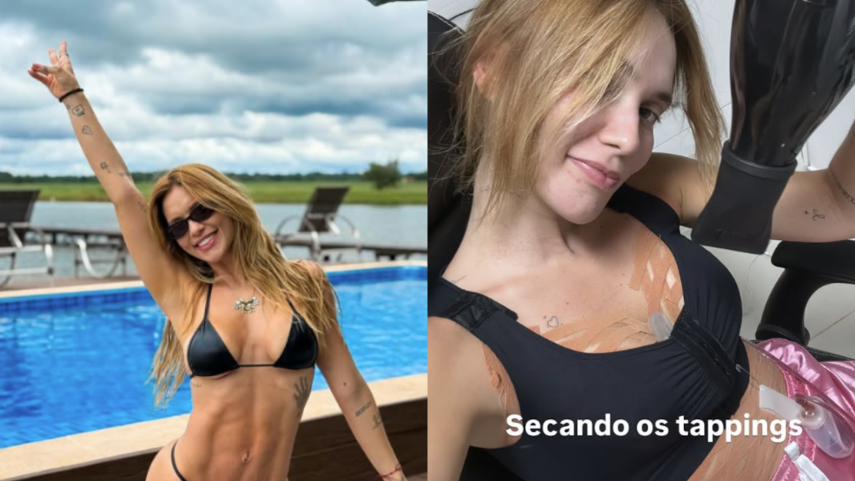 Virginia Fonseca atualiza estado de saúde após cirurgias: 'Acordando a noite inteira'