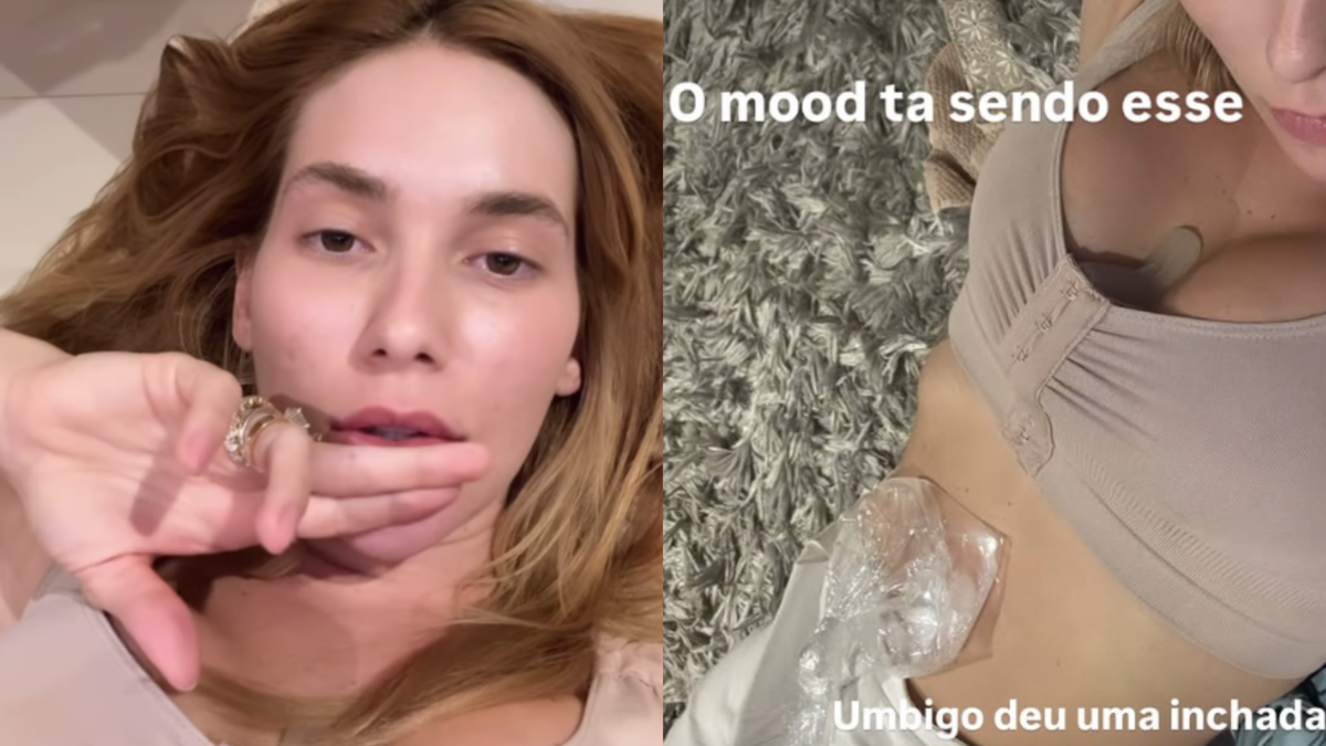 Virginia explica complicação após novo procedimento: 'Parte mais chata'