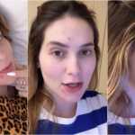 Grávida de 8 meses, Virginia enfrenta acne gestacional; entenda causas e tratamentos