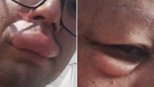 Vítimas ficaram com rosto deformado
