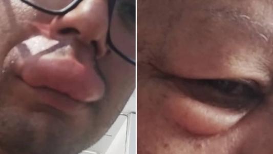 Vítimas ficaram com rosto deformado