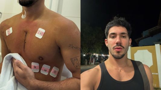 Vittor Fernando precisou ser internado na UTI