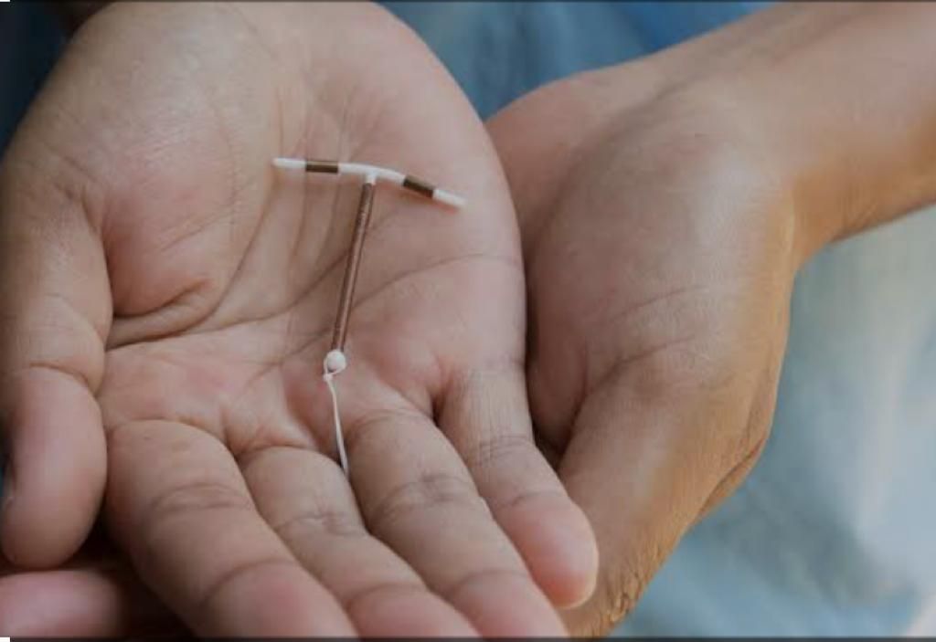 DIU hormonal não aumenta risco de trombose e ainda reduz fluxo menstrual, diz pesquisa da UFMG