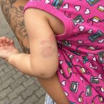 Polícia investiga denúncia de agressão a bebê de um ano em creche no RJ