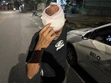 Taxista mostra cabeça enfaixada após ser agredido em BH