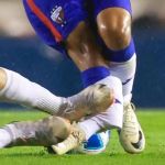 Dia do azar: atacante sofre fratura exposta após dividida no Campeonato Mexicano; veja