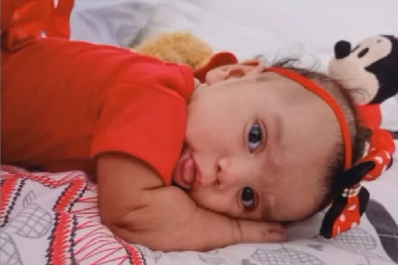 Investigações descartam agressões e abusos sexuais em bebê morta por cachorro no DF