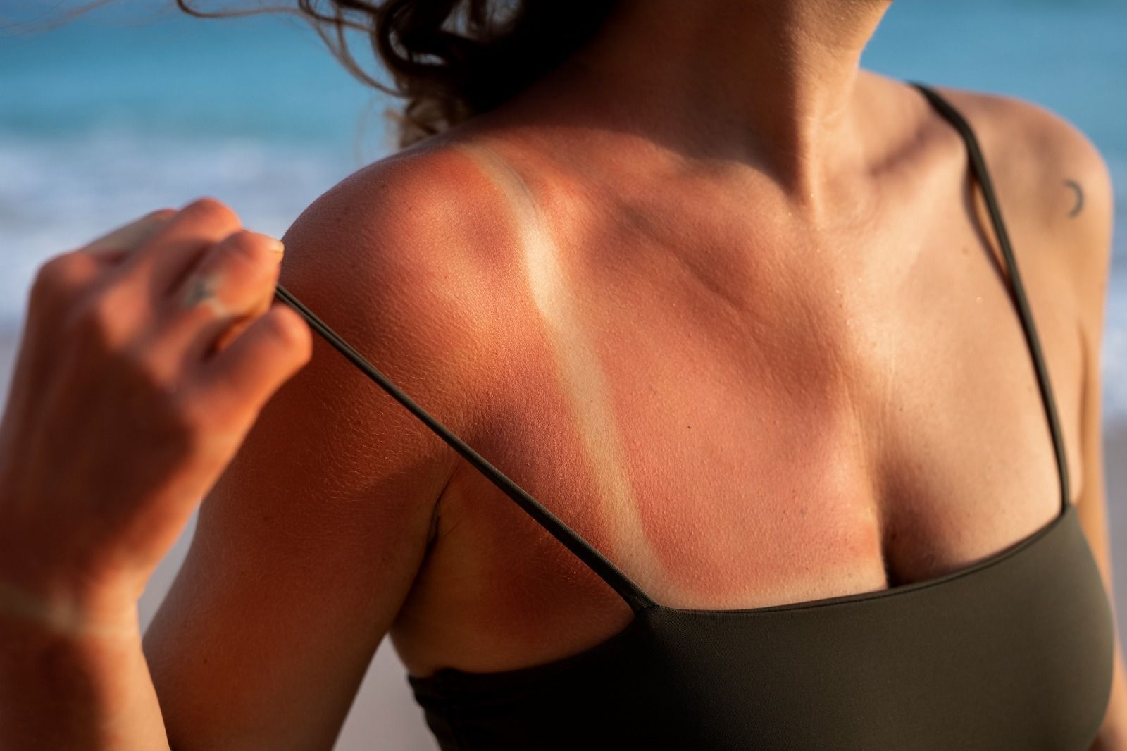 Anvisa proíbe comercialização e uso de lâmpadas utilizadas para bronzeamento artificial