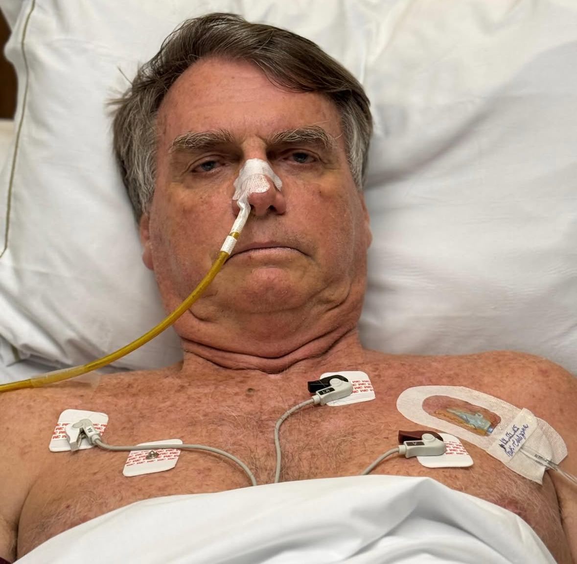 Bolsonaro posta foto em hospital e agradece mensagens de líderes internacionais: ‘Sigo firme’