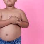 Obesidade pode interferir negativamente no tratamento contra câncer infantil