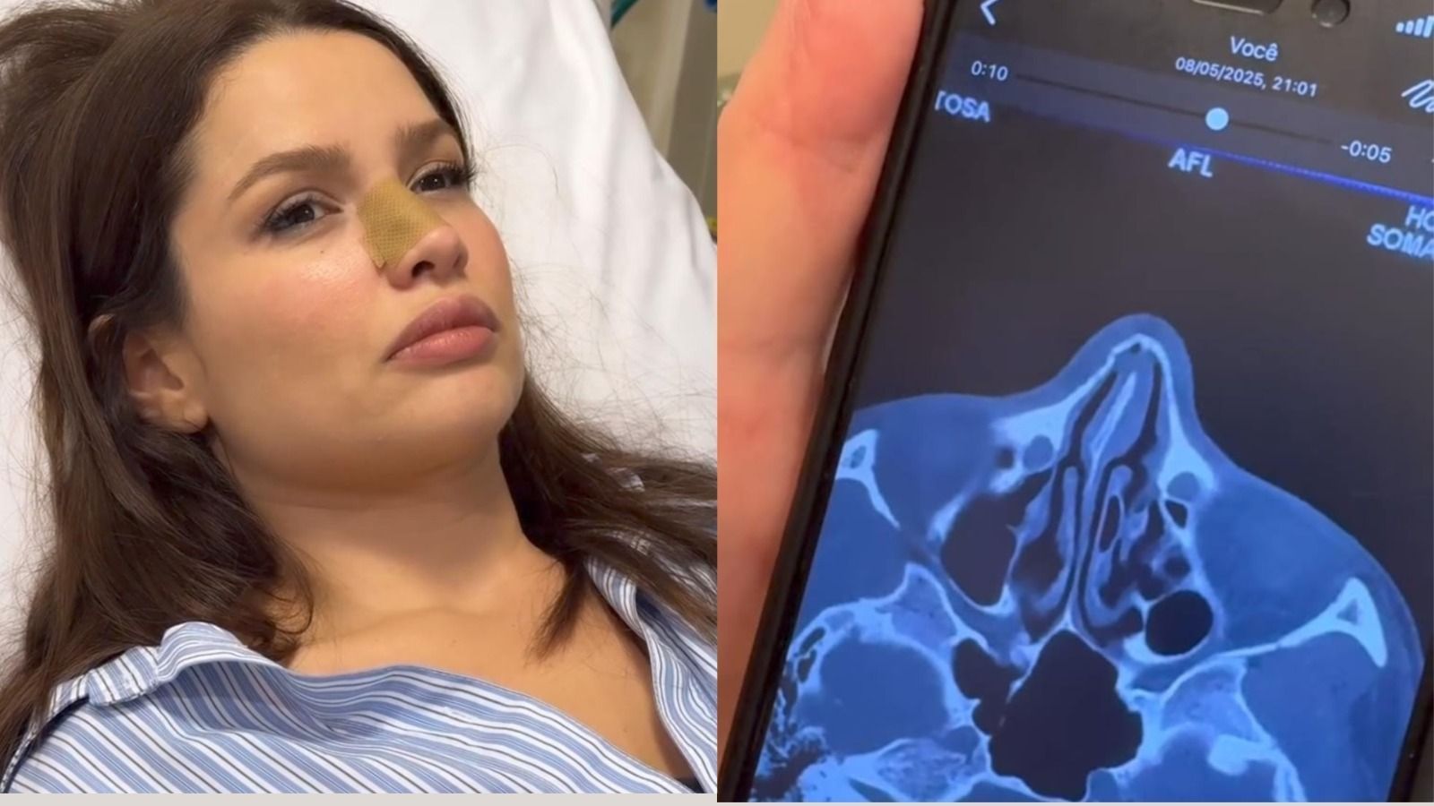 Juliette fratura nariz após bater o rosto em porta de vidro; veja vídeo do acidente