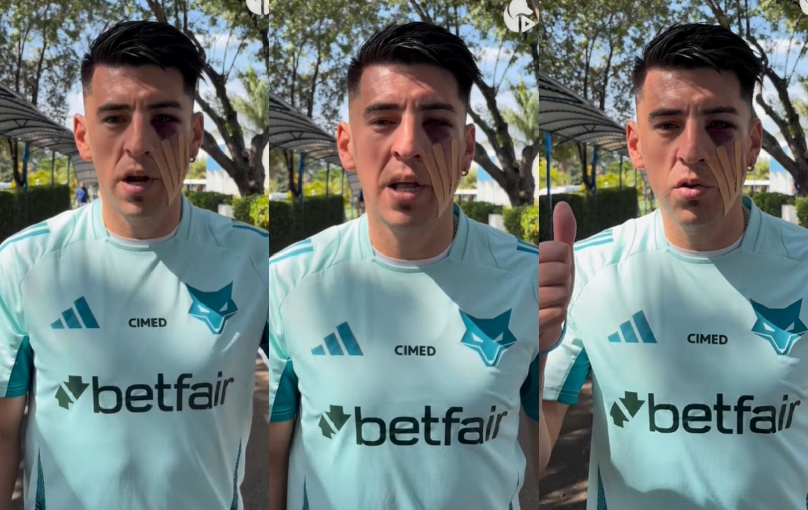 Preocupa? Villalba atualiza situação após pancada no rosto em goleada do Cruzeiro
