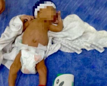 Bebê prematuro de apenas 29 dias precisou ser socorrido ao hospital.