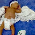 Bebê prematuro engasga com leite e é socorrido em Coração de Jesus