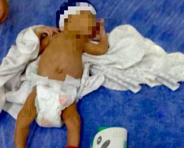Bebê prematuro de apenas 29 dias precisou ser socorrido ao hospital.