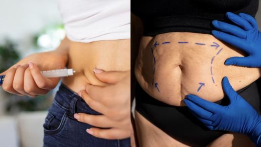 canetas emagrecedoras X cirurgia baria.jpeg