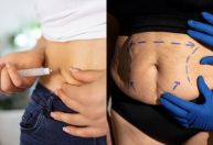 Cirurgia bariátrica e canetas emagrecedoras: médico explica diferenças e indicações