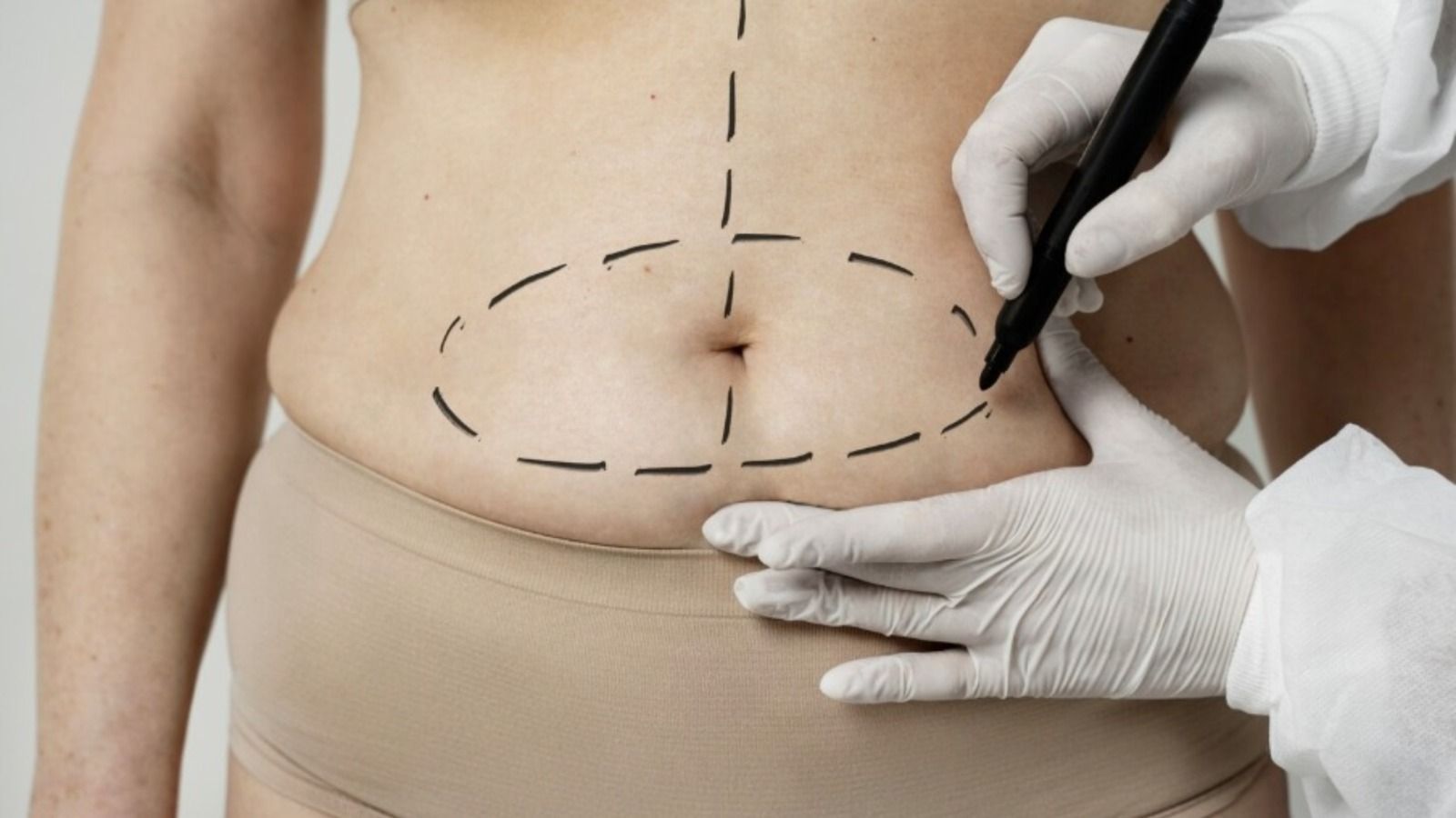 Massagem após cirurgia plástica não é mais recomendada, alerta fisioterapeuta