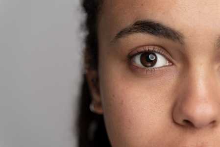 Glaucoma