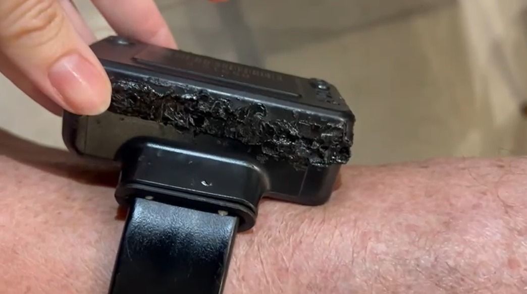 Bolsonaro admite que usou ferro quente para tentar violar tornozeleira; veja vídeo e fotos