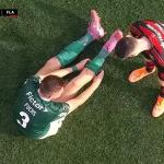 Palmeiras x Flamengo: como ficou perna de Bruno Fuchs após entrada de Pulgar