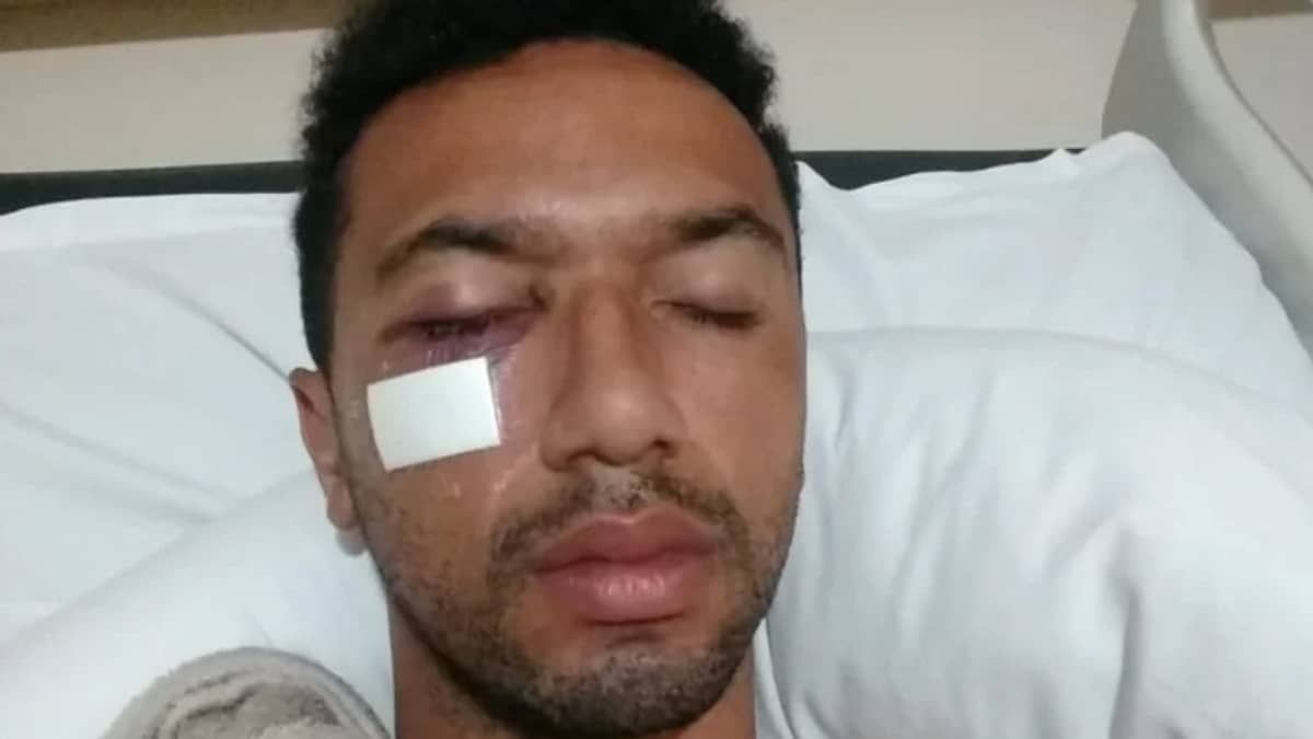 Ex-zagueiro de América e Palmeiras faz 'vaquinha' para pagar cirurgia 